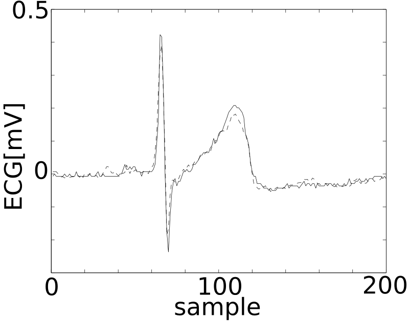 okuya_HeartRate